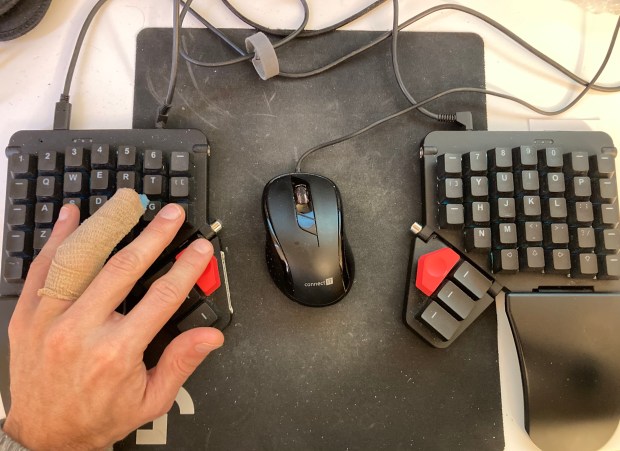 A hand with a strapped up finger using a keyboard